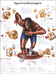 Lehrtafel - Sportverletzungen